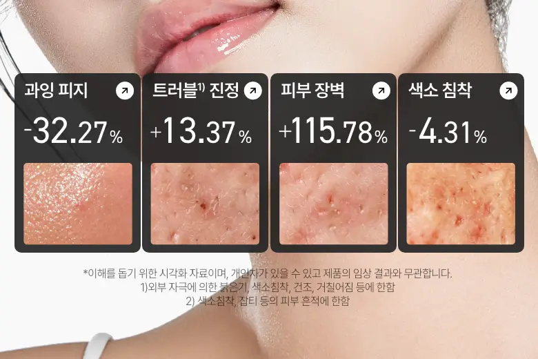 [단독기획] 아누아 어성초 센텔라 레드 스팟 크림 30g 2입 상세페이지 6